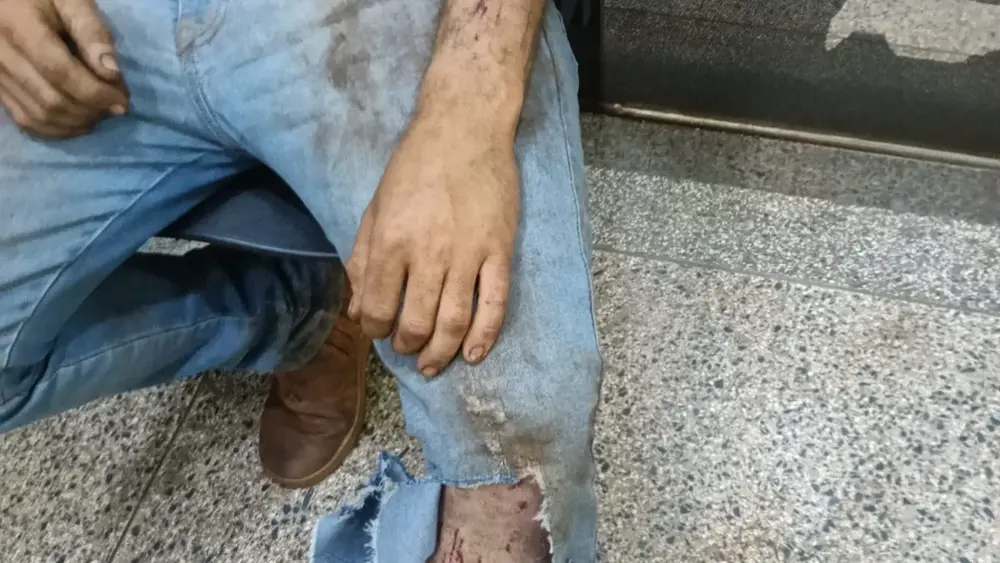 Jovem é atacado por suposta onça em colheitadeira em Ponta Porã